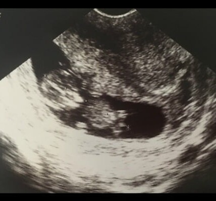 Baby Announcement