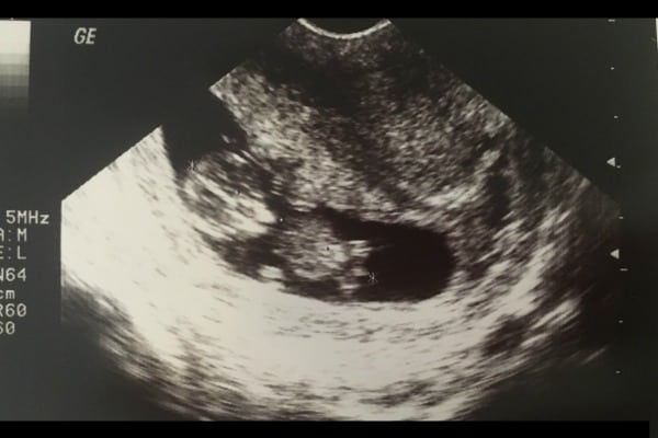 Baby Announcement